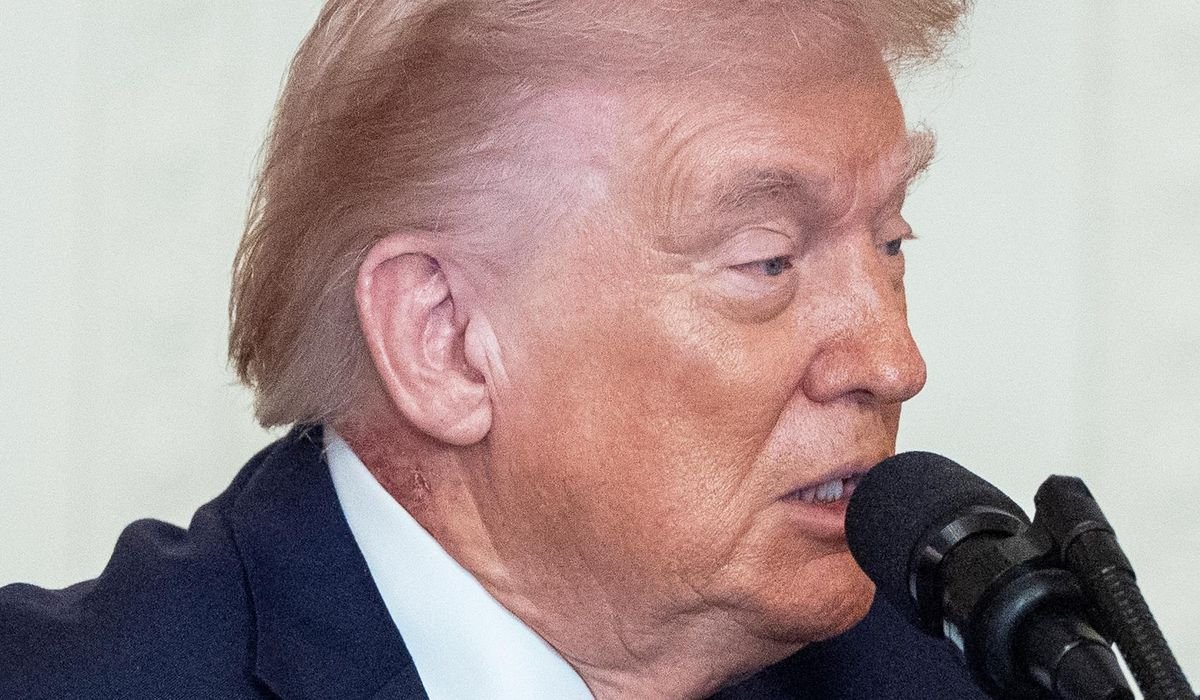 White House says Trump's red neck rash was caused by prescription skin cream